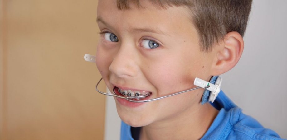 Aparelho Extra Bucal (AEB)