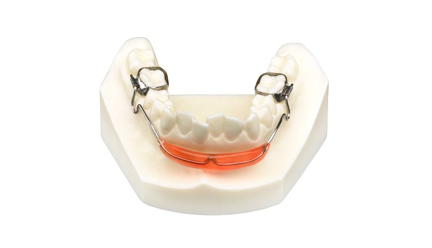 PLA (placa lábio-ativa)